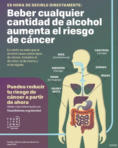 Cancer & Alcohol Straight Facts | Posters | Spanish